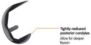 Tightly-radiused posterior condyles | Allow for deeper flexion