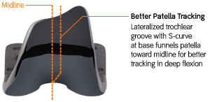 Better patella tracking | Lateralized trochlear groove with S-curve at base funnels patella toward midline for better patella tracking in deep flexion