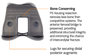 Bone Conserving
